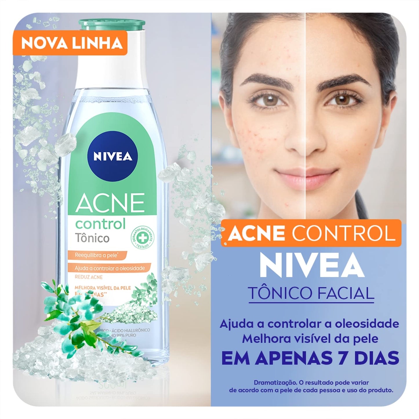 NIVEA Tônico Facial Acne Control 200ml - Ajuda a controlar a oleosidade, não obstrui os poros, remove células mortas, reduz a vermelhidão e hidrata a pele acneica